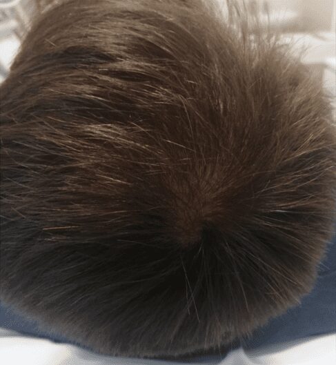 woman with thicker hair